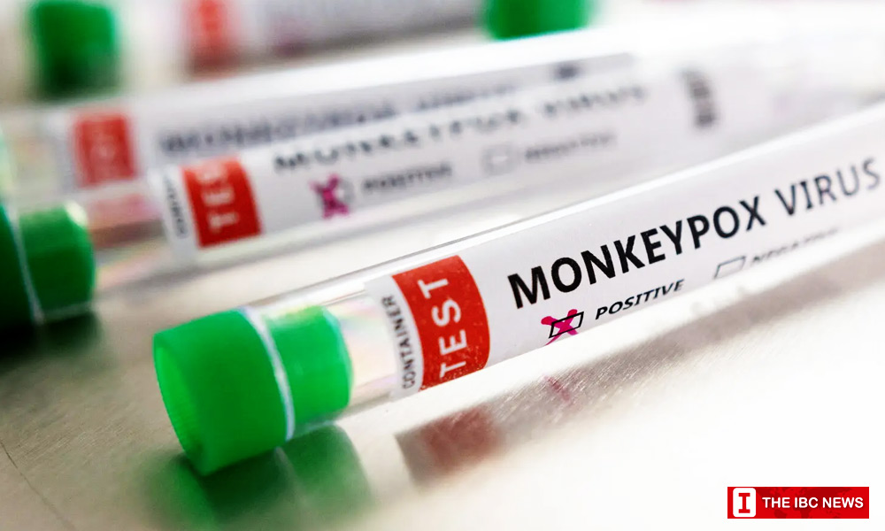 monkeypox news